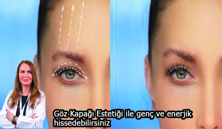 Göz Kapağı Estetiği ile genç ve enerjik hissedebilirsiniz